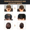 Root Activator Shampoo, Natural Hair Regrowth Shampoos, Unisex Hair Thickening Shampoo, Gently Shampoo For Men & Women